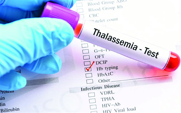 Thiếu máu mang gen Thalassemia, đừng chủ quan để mẹ tròn, con vuông