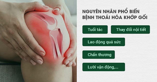 Thoái hóa khớp và nguy cơ bệnh tăng nặng trong mùa nóng