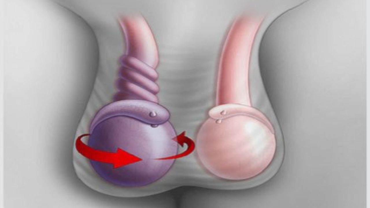 Thoát vị bẹn có nguy hiểm không? Cách điều trị bệnh hiệu quả