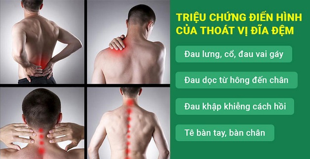 Thoát vị đĩa đệm có nguy hiểm không? Nhận biết và xử trí