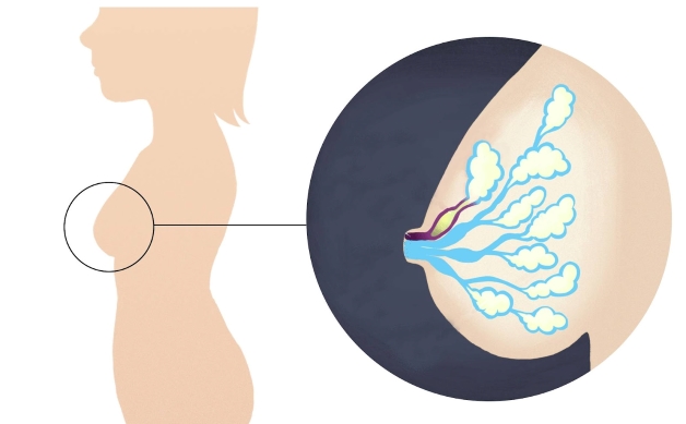 Thông tắc tia sữa sau sinh như thế nào hiệu quả?