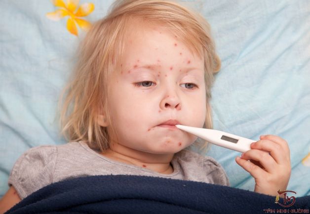 Thông tin chi tiết về việc tiêm vắc xin sởi quai bị rubella