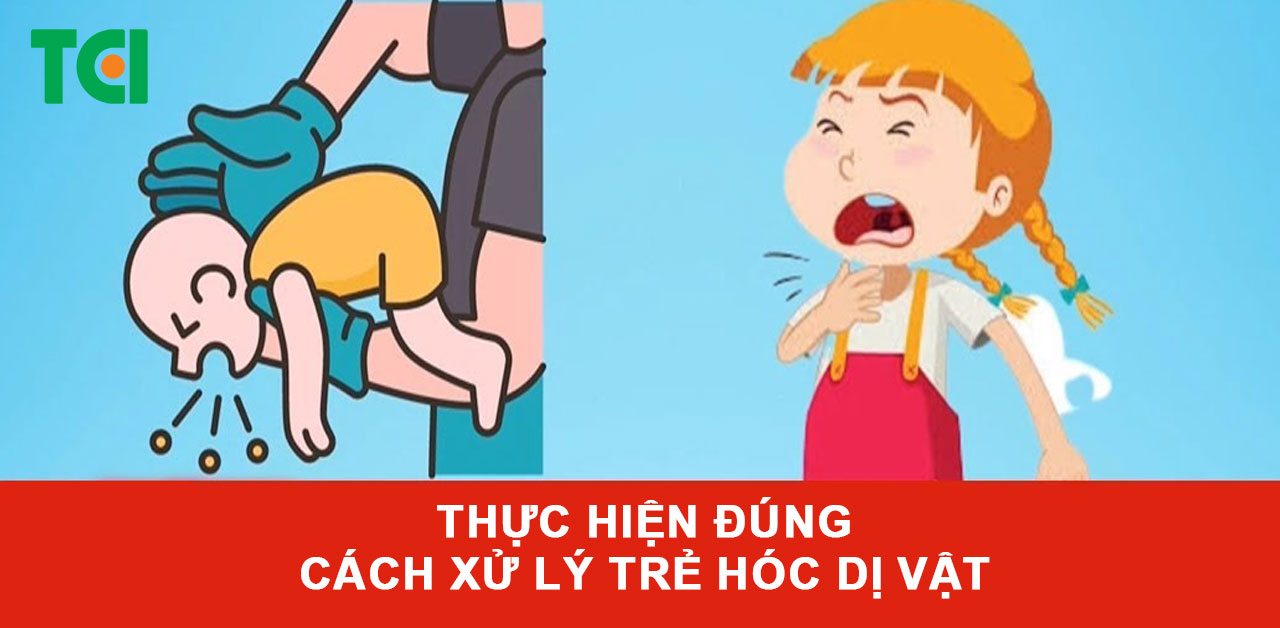 Thực hiện đúng cách xử lý trẻ hóc dị vật