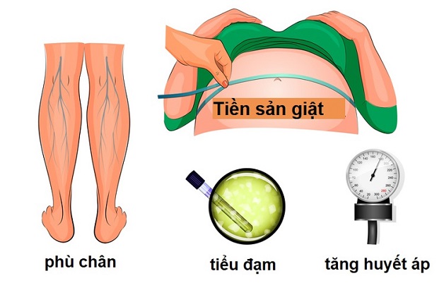 Tiền sản giật khi mang thai và những điều mẹ bầu cần lưu tâm