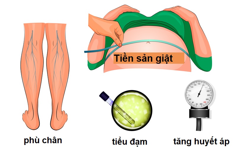 Tiền sản giật thai kỳ và biến chứng nguy hiểm mẹ bầu nên biết