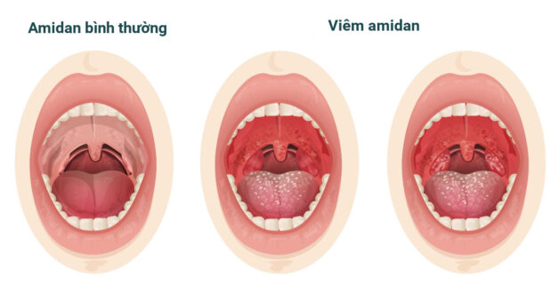 Tiêu chí lựa chọn bệnh viện khám tai mũi họng uy tín