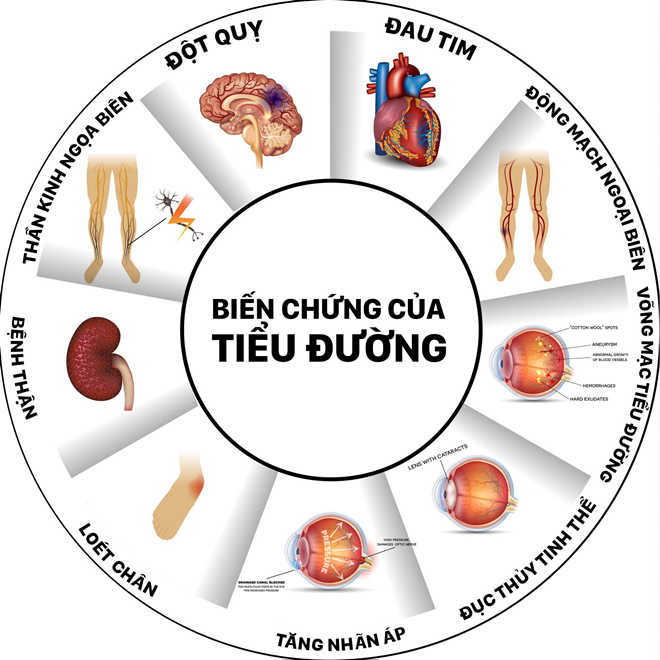 Tiểu đường tuýp 2 có chữa khỏi không?