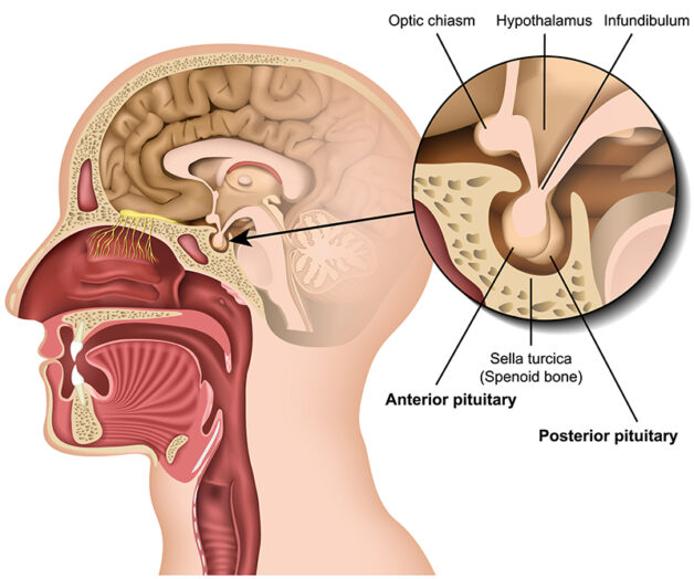 Tìm hiểu các bệnh về tuyến yên