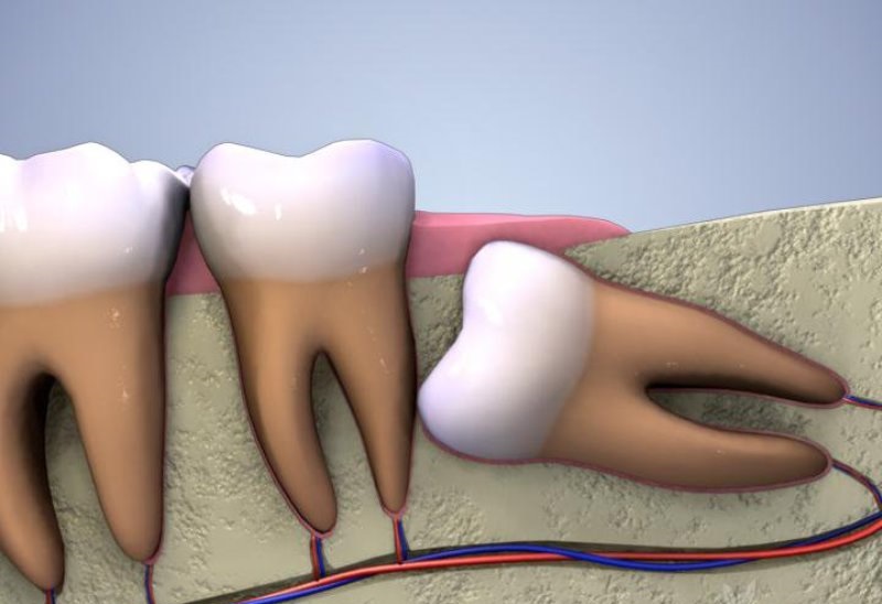 Tìm hiểu các loại thuốc đau răng thường được sử dụng