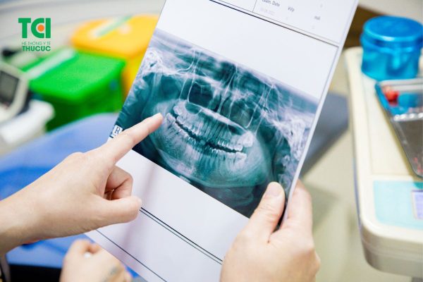 Tìm hiểu cấy ghép implant có an toàn không?