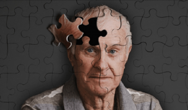 Tìm hiểu chi tiết triệu chứng bệnh Alzheimer