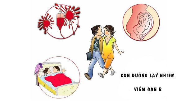 Tìm hiểu chồng bị viêm gan B có lây sang vợ không