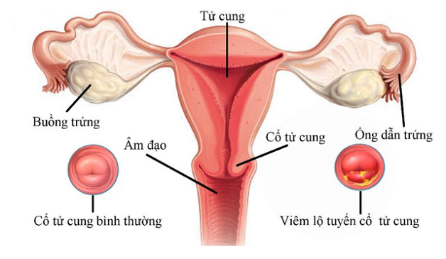 Tìm hiểu máu kinh có dịch nhầy là bị bệnh gì?