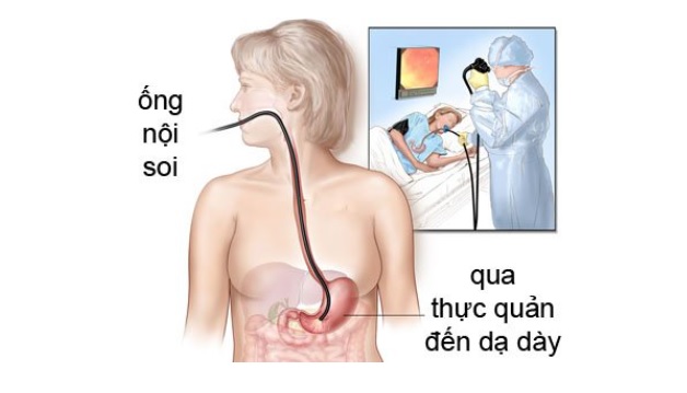 Tìm hiểu phương pháp nuôi cấy vi khuẩn hp