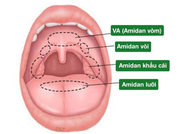 Tìm hiểu toàn bộ bệnh viêm amidan