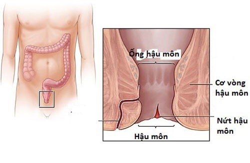 Tìm hiểu về bệnh nứt kẽ hậu môn