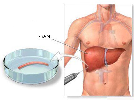 Tìm hiểu về chi phí sinh thiết gan cho bệnh nhân ung thư