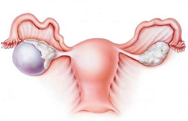 Tìm hiểu về chức năng của buồng trứng trong sinh sản