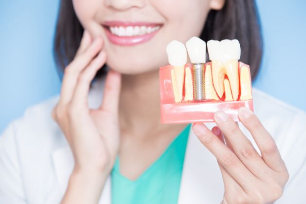 Tìm hiểu về công nghệ trồng răng Implant