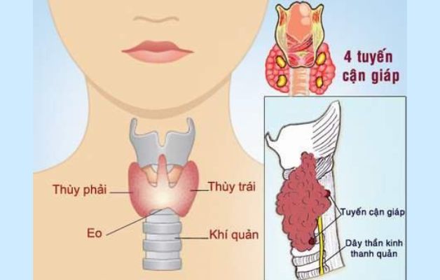 Tìm hiểu về eo tuyến giáp