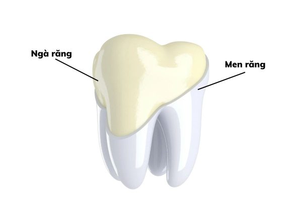 Tìm hiểu về hình thể răng trong cung hàm