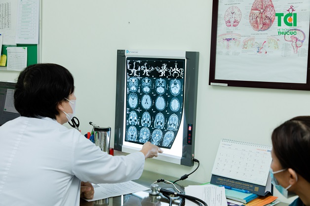 Tìm hiểu về phương pháp chẩn đoán hình ảnh Alzheimer