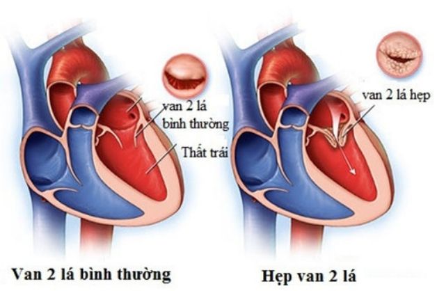 Tìm hiểu về phương pháp chẩn đoán hình ảnh X quang tim