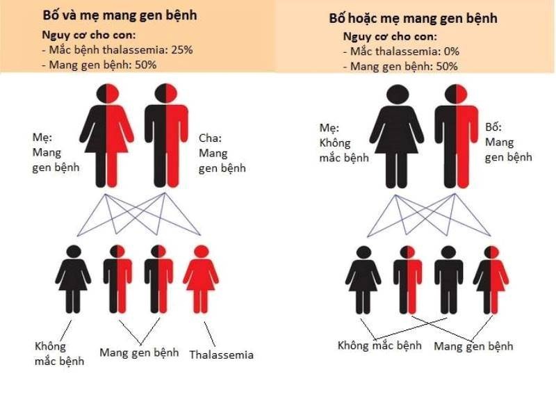 Tìm hiểu về thiếu máu di truyền ở trẻ em