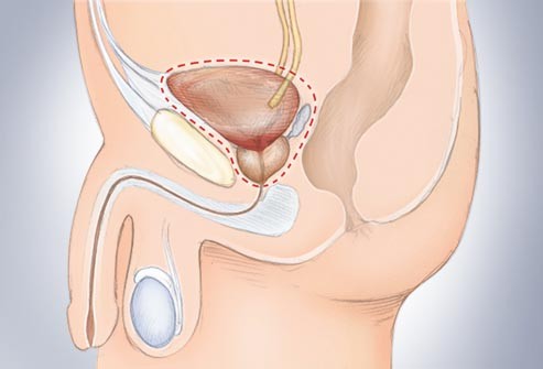 Tìm hiểu về ung thư bàng quang qua các hình ảnh