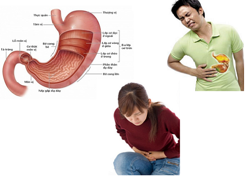 Tìm hiểu về viêm đại tràng mạn tính ai dễ mắc bệnh này