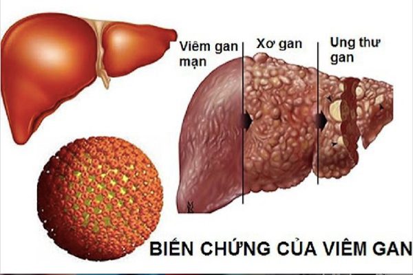 Tìm hiểu vị trí của gan và những điều “thú vị”