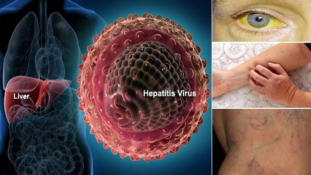 Tìm hiểu virus viêm gan B lây truyền qua đường nào?