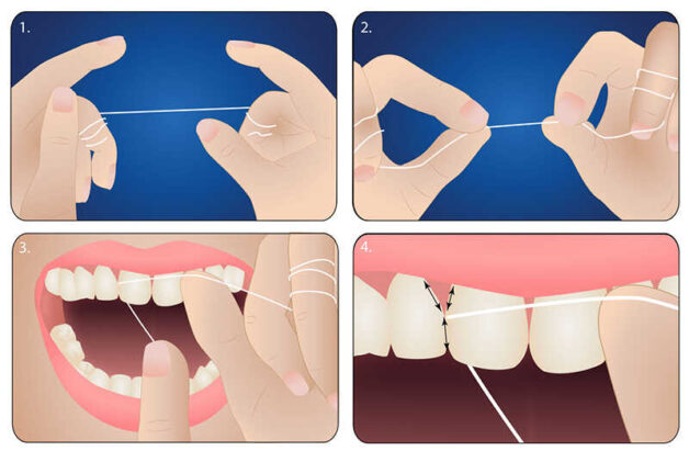 Tìm lời giải đáp cho vấn đề làm sạch cao răng tại nhà