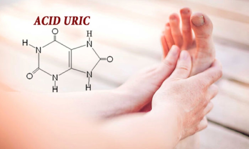 Tình trạng Acid Uric cao và những lưu ý phòng tránh