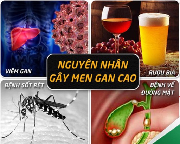 Tổng hợp các nguyên nhân men gan cao và cách điều trị