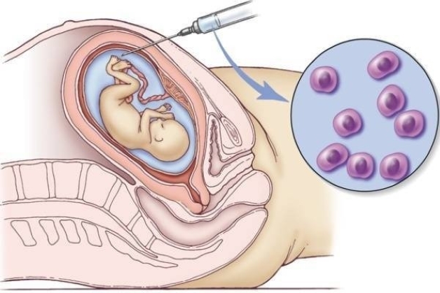 Tổng hợp các xét nghiệm sàng lọc trước sinh cần thực hiện