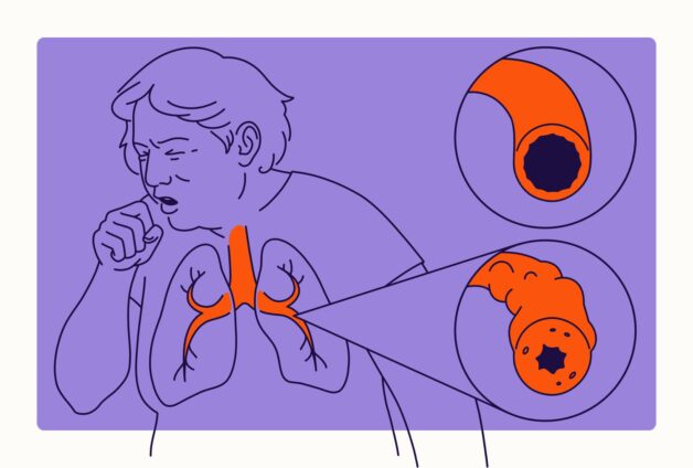 Tổng hợp thông tin về bệnh COPD