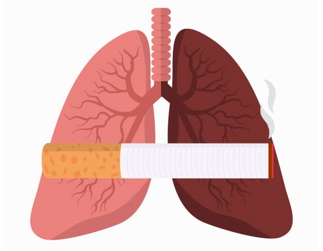 Tổng hợp thông tin về bệnh COPD