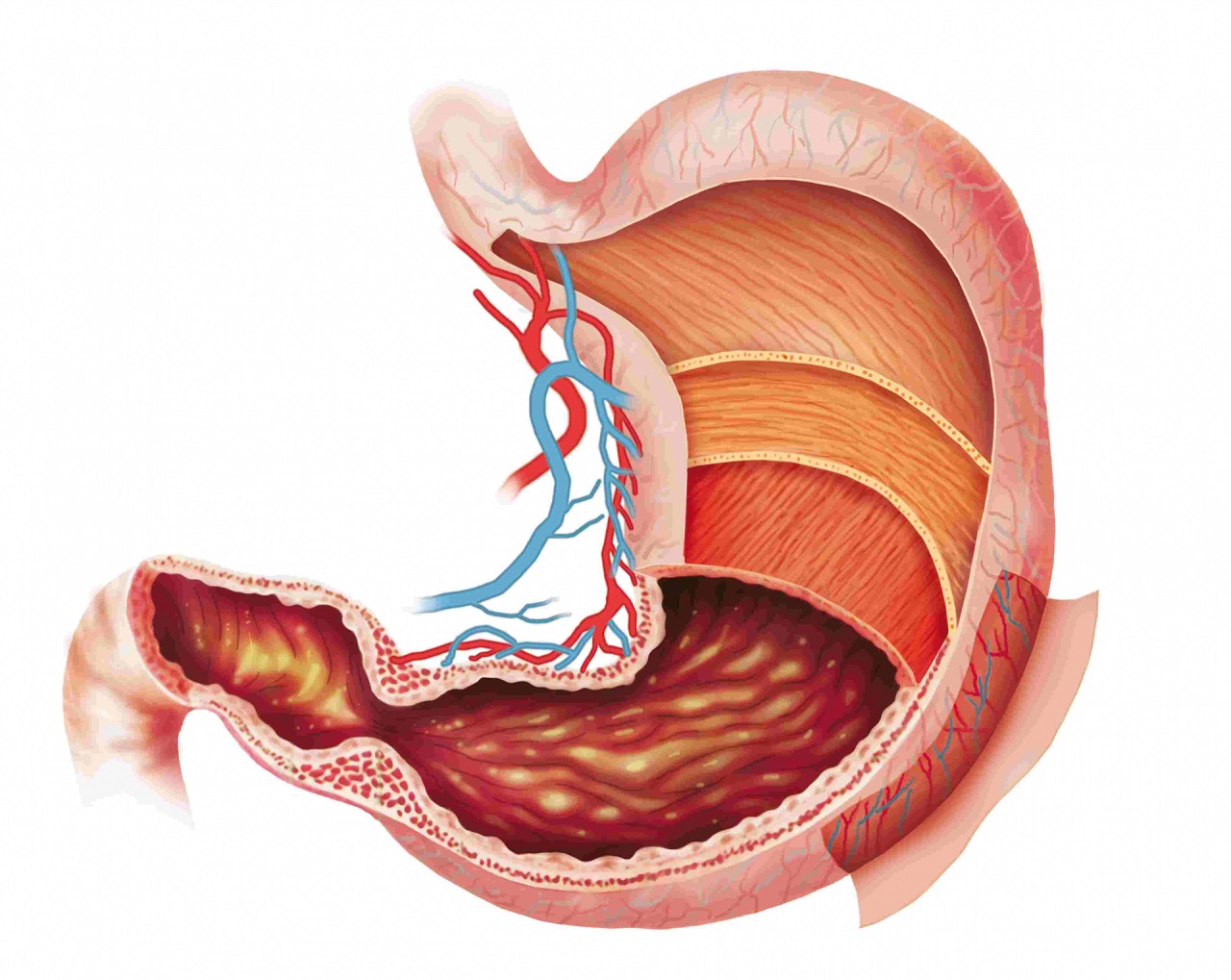 Tổng quan về viêm dạ dày ruột ở người lớn