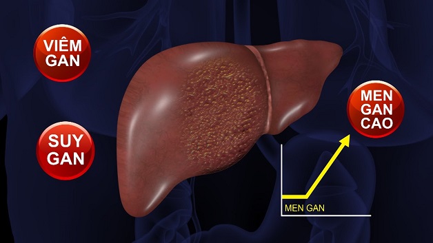 Top 10 cách hạ men gan ngay tại nhà hiệu quả