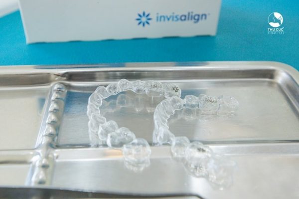 Top 5 ưu điểm vượt trội chỉ có ở niềng răng Invisalign