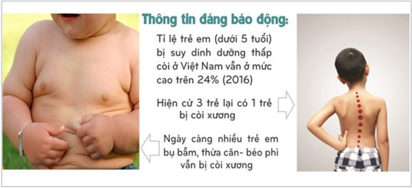 Trẻ còi xương thể bụ – Lý do vì sao bé bụ bẫm