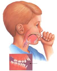 Trẻ mút tay đọc ngay để có biện pháp xử trí hiệu quả