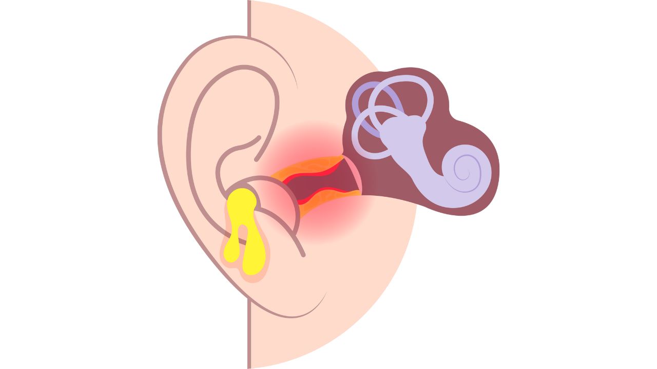 Trẻ nhỏ bị viêm tai giữa: Hướng dẫn nhận biết và điều trị