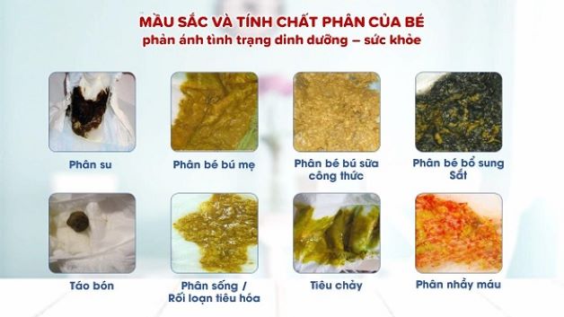 Trẻ sơ sinh bị tiêu chảy sủi bọt, cha mẹ cần làm gì?