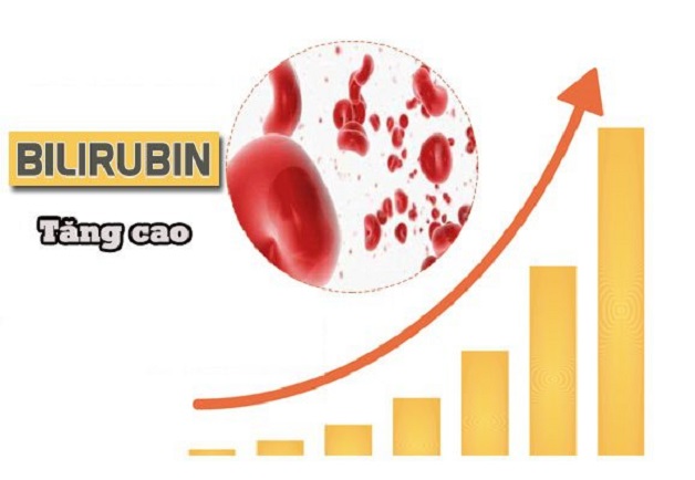 Trẻ sơ sinh bị vàng da là tiềm ẩn của những bệnh lý gì? 