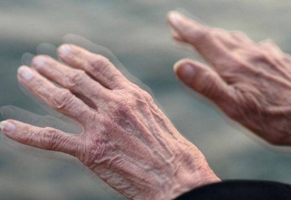 Triệu chứng bệnh Parkinson: Hiểu rõ để nhận diện sớm