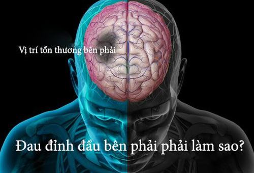 Triệu chứng đau ở đỉnh đầu và những bệnh liên quan