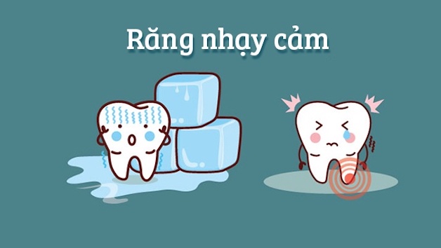 Triệu chứng răng nhạy cảm, nguyên nhân và cách ngừa bệnh