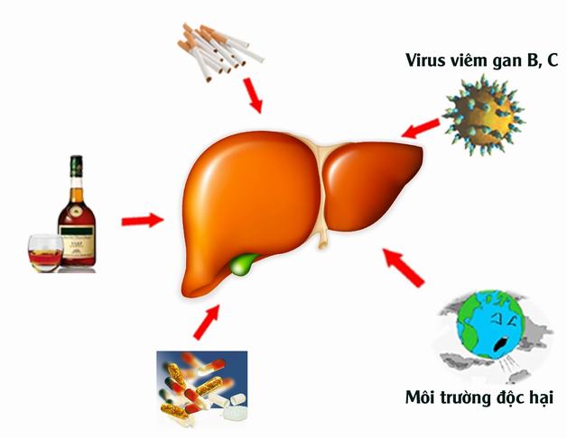 Triệu chứng rối loạn chức năng gan thường gặp